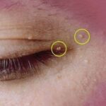 THE MOST POTENT HERB THAT DESTROYS PARASITES, URINARY TRACT …