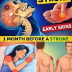 Have you noticed small white spots on your arms or legs… and you don’t know what they are