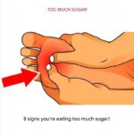 What Happens to the Body After Gallbladder Removal? 3 Diseases That May Follow – Avoid Surgery If Possible
