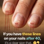 I thought bleach stains were permanent… until I learned this quick trick that can fix them in minutes